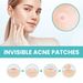West & Month réparateur d'acné et de pores d'acné, correcteur Invisible et respirant, Patch de nettoyage imperméable pour l'acné_voghion.com