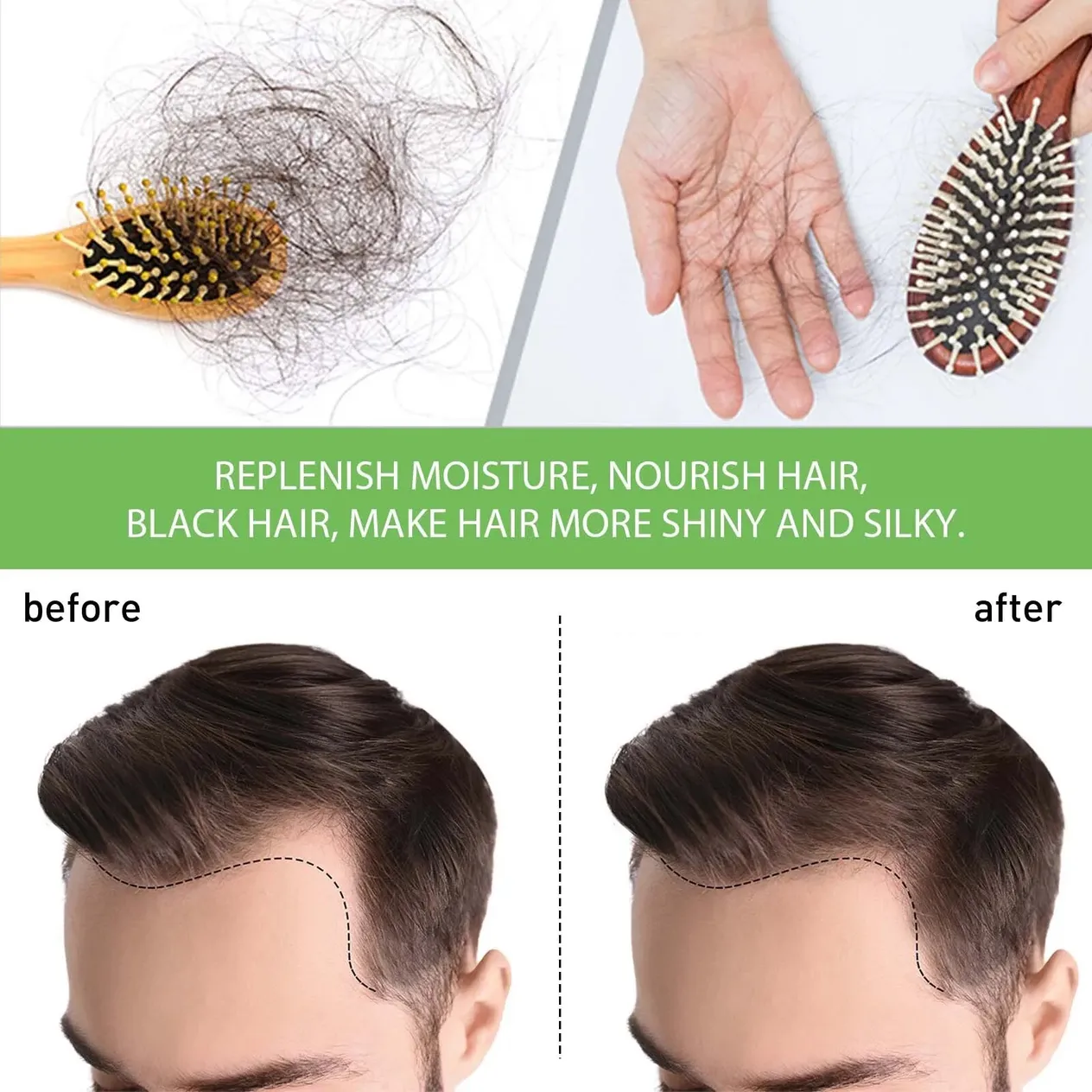 Hair Growth Oil Effective Prevent Hair Loss Moisturize Scalp Care Hair Follicle Nourishing Stimulates Thicker Hair Beauty Health_voghion.com