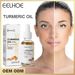 Turmeric Serum Dark Spot Corrector Remove Wrinkles Freckle Turmeric Face Cream_voghion.com