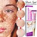 Nicotinamide Whitening Freckle Removing Cream Effectively Remove Melasma Dark Spot Acne Marks Lightening Melanin Face Skin Care_voghion.com