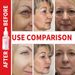 Beauty Care Shop IN 1 4 Falten entfernen Gesichtsserum Lifting Straffung feine Linien verblassen lassen Anti-Aging Essenz Vitamin C Aufhellung Feuchtigkeit_voghion.com