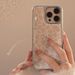 A estampa de leopardo amarela da Ins se aplica à capa de celular Apple 15 Pro Max de 16 polegadas, ao iPhone 14, com revestimento eletrolítico em epóxi e à capa rígida Huawei de 17 polegadas._voghion.com