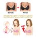 Eelhoe with plump firm texture, beauty care, ginger enhancement patch, enlargement and breast lifting patch_voghion.com