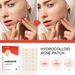 EELHOE Patch colloidale Trucco invisibile per il viso Pulizia della bocca chiusa Riparazione della pelle dell'acne impermeabile e traspirante_voghion.com