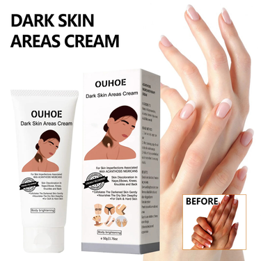 Body Whitening Cream Private Parts Armpit Knee Buttocks Bleach Lotion Inner Thigh Remove Melanin Pigmentation Brighten Dark Skin_voghion.com