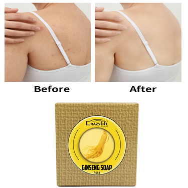 Crazylife Ginseng Essential Oil Sophora flavescens Facial Cleaning Hand Bathing Soap_voghion.com