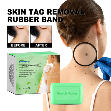 South Moon wart removing moles, warts on the face neck, granulation filamentous warts, and body cleaning soap_voghion.com
