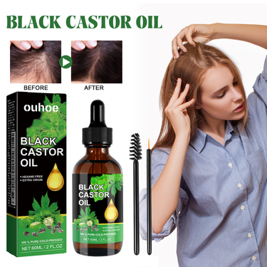 OUHOE castor oil conditioner improves hairline toughness, nourishes roots, softens hair, and prevents hair loss_voghion.com