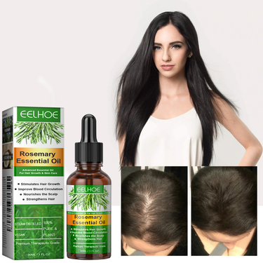 Rosemary Essential Oil Nourishes Roots, Fixes Denses Hair, Improves Dry, Fury, and Softens Hair Care 2024 popular_voghion.com