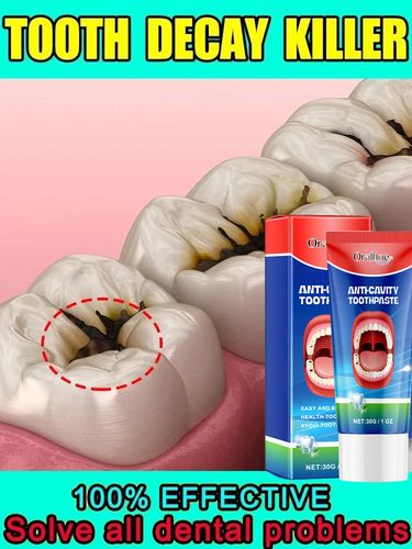 Cavity Anti-cavities Toothpaste Teeth Whitening Bad Breath Repair Cavities Remove Plaque Toothache Relives Periodontitis_voghion.com