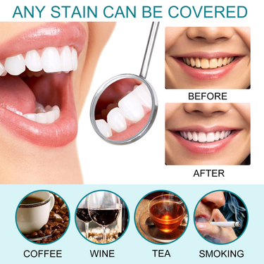 Tooth 24ss Whitening Stains Stains, Preventing Pigment Deposition, Cleaning Oral Odors, and Caring for Teeth Paint ,_voghion.com