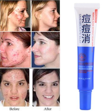 30g Acne Comedo Pimples Removal Shrink Pore Moisturizing Skin Care Cream_voghion.com