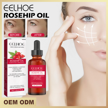 Fruit Beautiful Rose Facial Essential Oil Moisturizing, Moisturizing, Skincare, Softening, Hair Massage Essential Oil_voghion.com