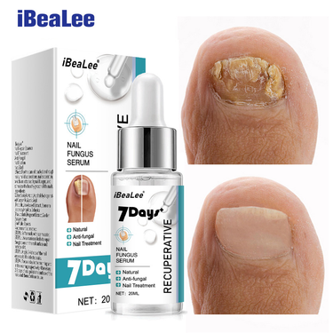 nail Special antibacterial removal cream thickening soft nails, and special solution for gray nails s, s_voghion.com