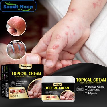 South Moon Hand and Foot Yan Skin Dry Scratchy Mosquito Bite Anti Itching Cream_voghion.com