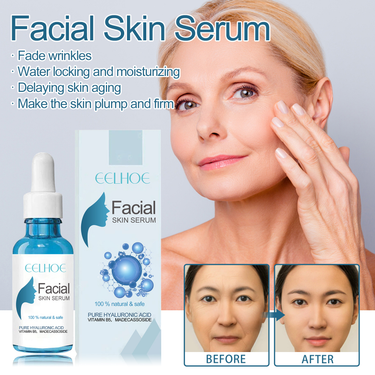 EELHOE Moisturizing and Firming Skin aging&Fading Facial Spots&Fine Lines Anti wrinkle essence_voghion.com