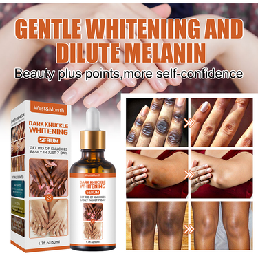 50ml Whitening Serum 7 Days Remover Get Rid Of Dark Knees Dark Knuckle Elbow Cream Nicotinamide Brighten Skin Tone 2023 New_voghion.com