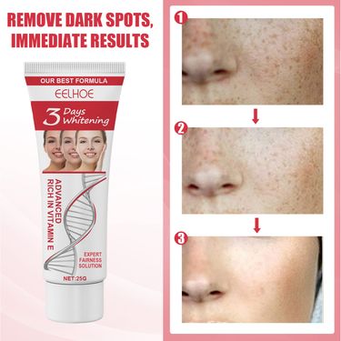 Eelhoe 3-day Kojic Acid Moisturizing Brightens Tone Moisturizes Face Beauty Cream Reduces Spots And Tightens Skin_voghion.com