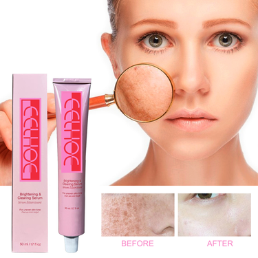EELHOE Black Spot essence Lotion Diminish spots, replenish melanin, moisturize, repair and brighten skin_voghion.com