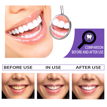 EELHOE Tooth Whitening Beautifying Teeth Removing Stains and Odors Oral Care Cleaning Brightening Toothpaste_voghion.com