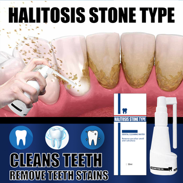 Hislaves 30ml/Bottle Teeth Removing Water Effective Quick Effect Easy to Carry Halitosis Dental Cleaning Water for Home_voghion.com