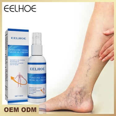 massage Beautiful vein varicose spray relieves venation, smoothes earthworm leg, relieves pain of leg vascular protube_voghion.com
