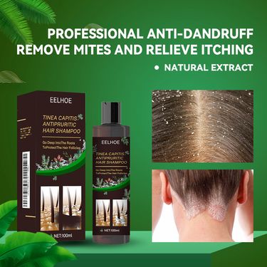 Hair Shampoo For Tinea Capitis Antipuriticprofessional Antidandruff Remove Mites Andrelieve Itching Shampoo 100ml Party Favours_voghion.com