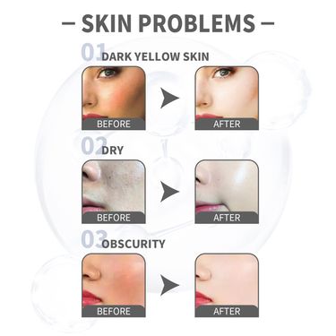 EELHOE Moisturizing Beauty Makeup Cream to lighten blemishes fine lines, brighten tighten, moisturize and beautify the_voghion.com