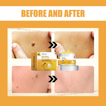 Ximonth Kwart Series Gentle Cleansing, Moisturizing And Desalting Skin Label Skin Care Topical Kow Care_voghion.com