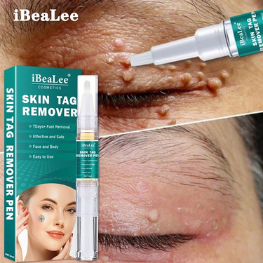 pen for IBeaLee removing flat especially sharp warts, remover liquid, cream, and wart leveling liquid_voghion.com