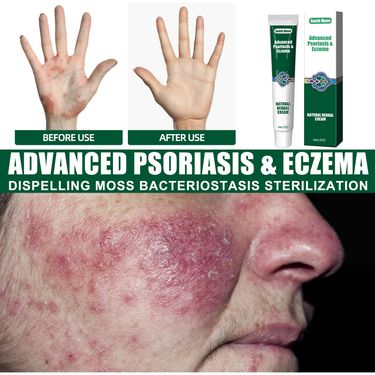 South Moon Wet Search Herbal Cream, Skin Cream Moisturizes, Hydrates And Reduces Itching Herbal Cream_voghion.com