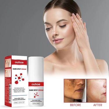 OUHOE Repairs Darkness, Decreases Fine Lines, Black Spot Pigment, Brightens Skin Repair Cream_voghion.com