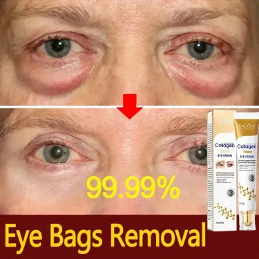 Instant Bag Removal Cream Collagen Anti-Wrinkle Fade Fine es Firming Skin Anti Dark Circle Puffiness Brighten Eye Care_voghion.com