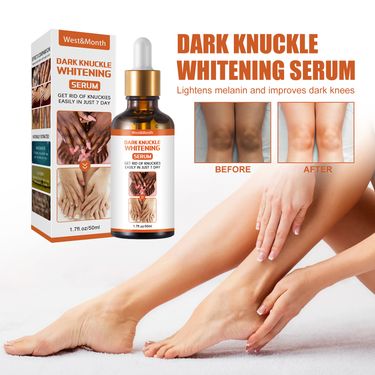 West&Month Skin Blackening Essence Brightening Knee Ankle Horn Melanin Removing Moisturizing Essence_voghion.com