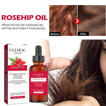 EELHOE Rose Fruit Facial Moisturizing, Skincare, Softening, Hair Massage Essential Oil_voghion.com