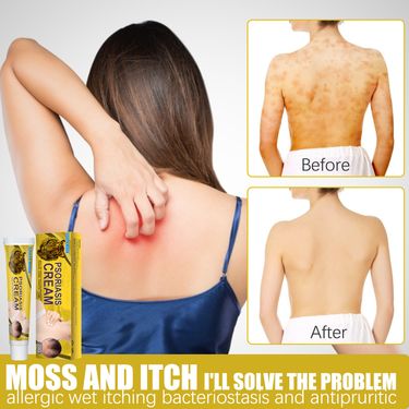 South Moon Repair Moss and Sweat Spot Topical Application Ointment Skin Antipruritus Cream_voghion.com