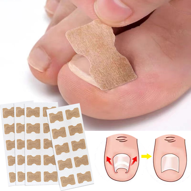 50/100pcs Toenail Correction Patch Eliminates Toe Pain Effective Treatment Paronychia Recover Toe Nail Care Co_voghion.com