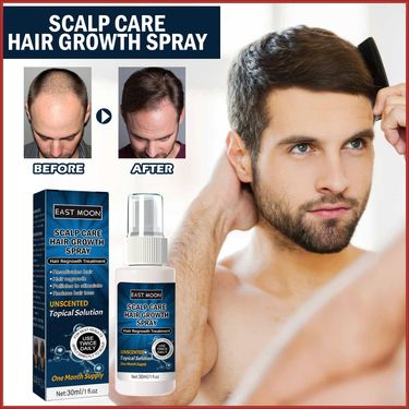 East Moon Men's Growth Essential Oil Spray For Thick Hairline, Anti-Hair Loss, Hair Strengthening Care Solution_voghion.com