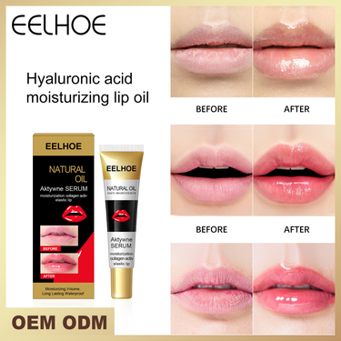 lines, Eelhoe reduces prevents dryness, cracks, moisturizes, removes dead skin, and provides care with lip oil_voghion.com