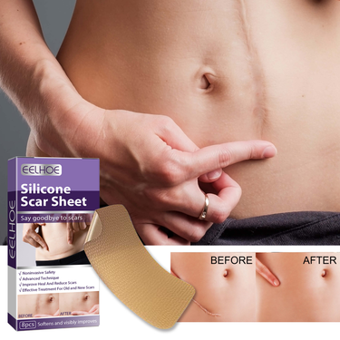 EELHOE silicone to lighten pregnancy cesarean section surgical hyperplasia scar repair patch_voghion.com