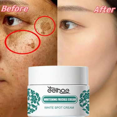 Niacinamide Melasma Brightening Cream Reduce Melanin Brighten Cream Lighten Dark Skin Chloasma Serum Fade Fine Face Lines_voghion.com