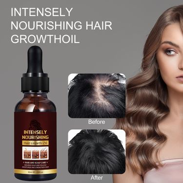 Hair Growth Essential Oil Accelerate Growth Nourishing Thickening Hair Deep Maintain Hair Loss Products Fast Grow Repair Coconut Oil Hair Supplies_voghion.com