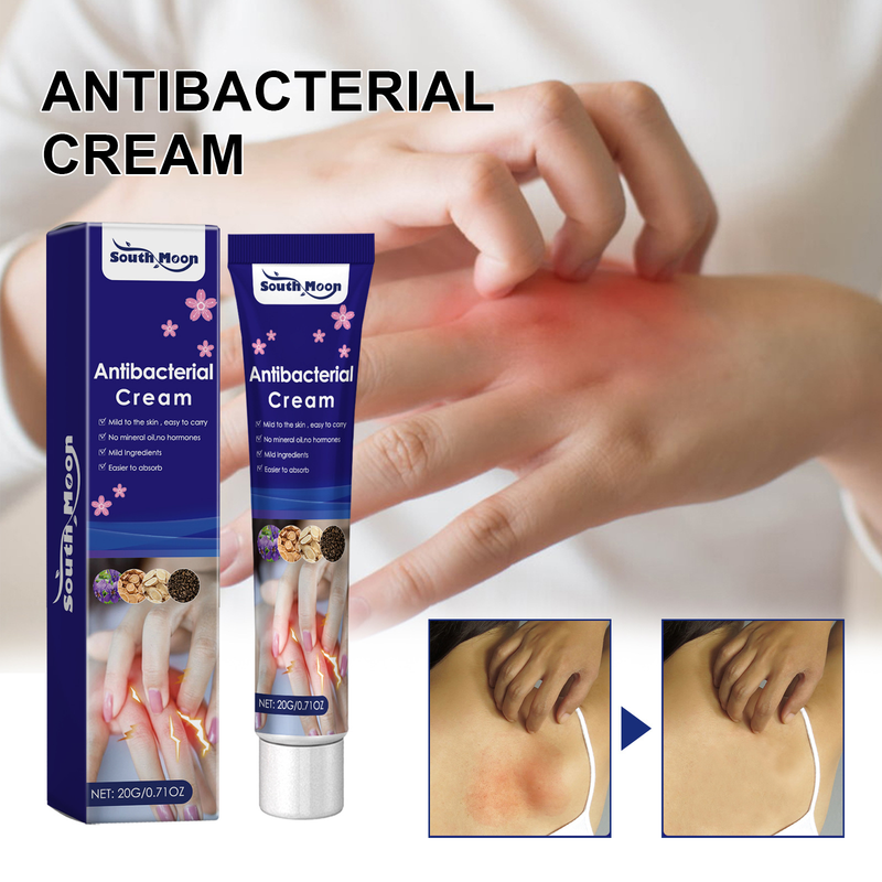 South Moon Zihua Di Ding Skin Antipruritus Tørr hud, kløe, rødhetslindrende fuktighetsgivende pleiekrem_voghion.com