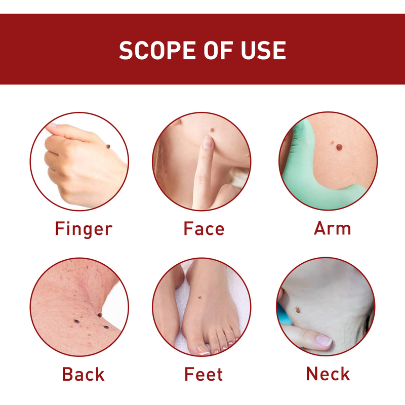 Anti Mole pour un nettoyage en profondeur de la peau, élimination des verrues, dessalinisation des grains de beauté noirs, réparation et lissage_voghion.com