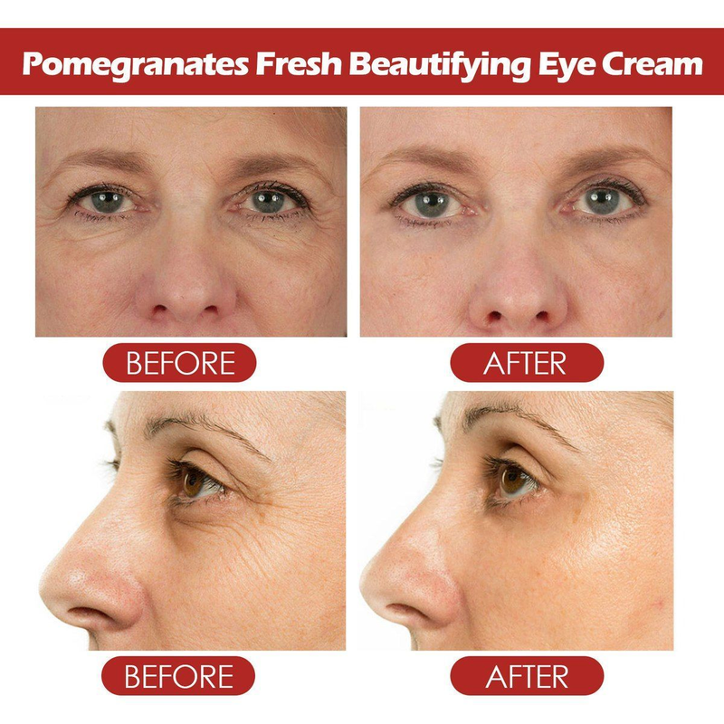 Pomegranate Eye Cream to lighten fine lines crow's feet, moisturize, tighten and care for skin around the eyes_voghion.com