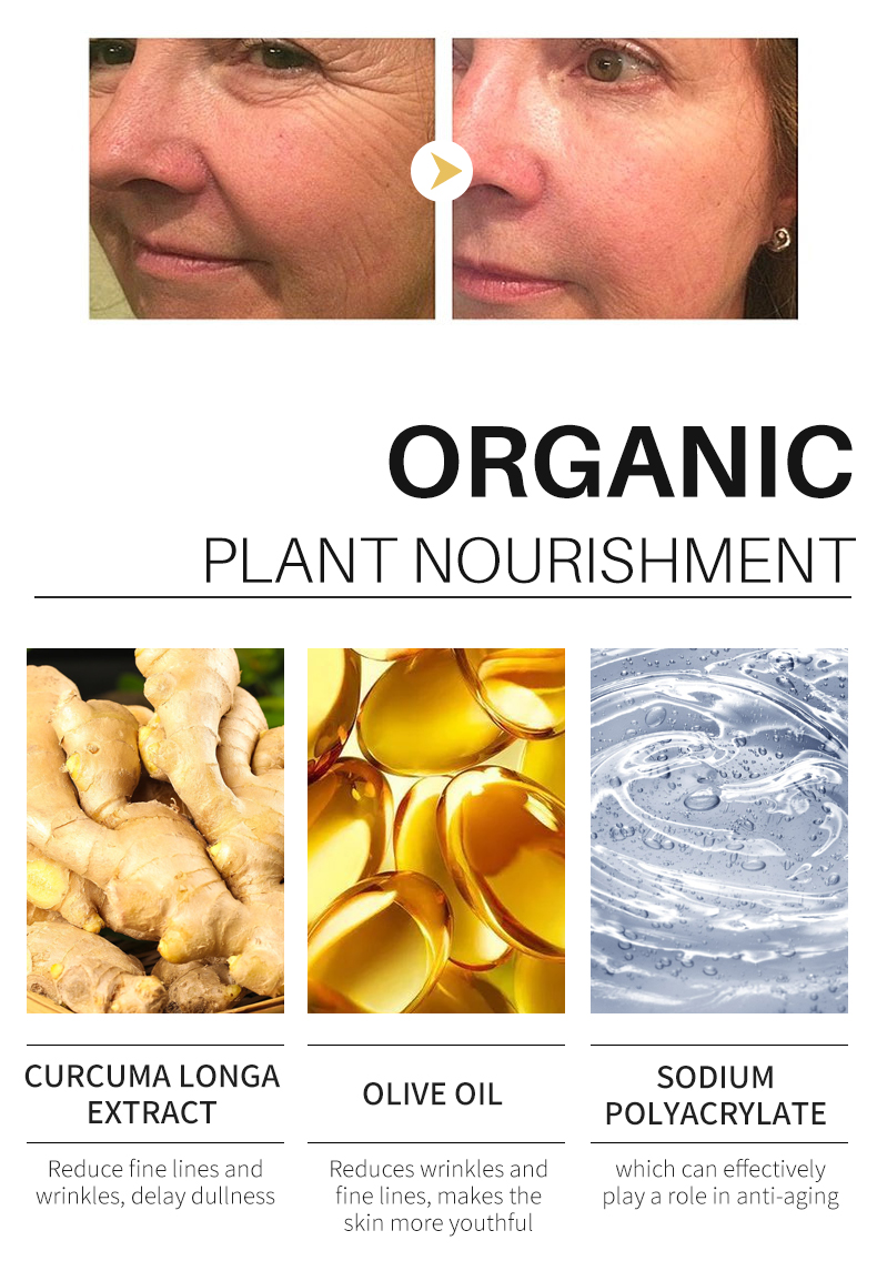 Lemon Oil Turmeric Glow To Lightening Patches, Acne Bright Skin Dark Spot Corrector Face Whitening S_voghion.com