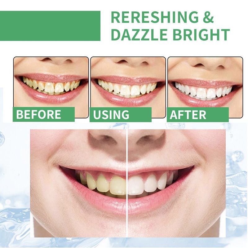 Fresh Tooth Powder, Whitening Gum Protection, Gentle Breath Freshening, Removes Stains And Brightens Teeth, Mint_voghion.com