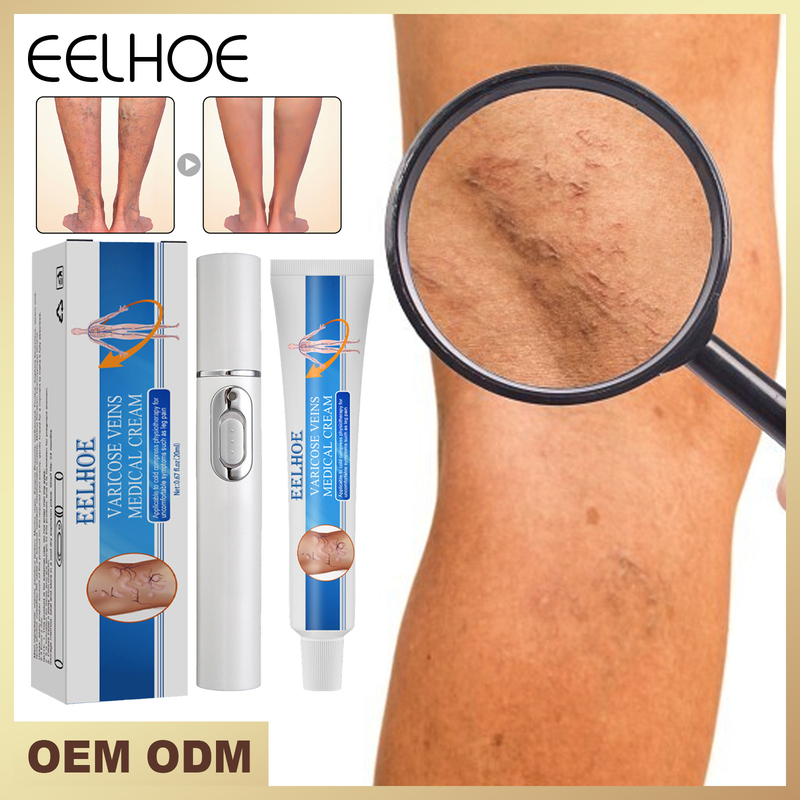 Reparation Vacker venös kräm Lugnande venös ådermassage Varicose Relief Cream Ben Vaskulär utbuktande smärtkräm_voghion.com