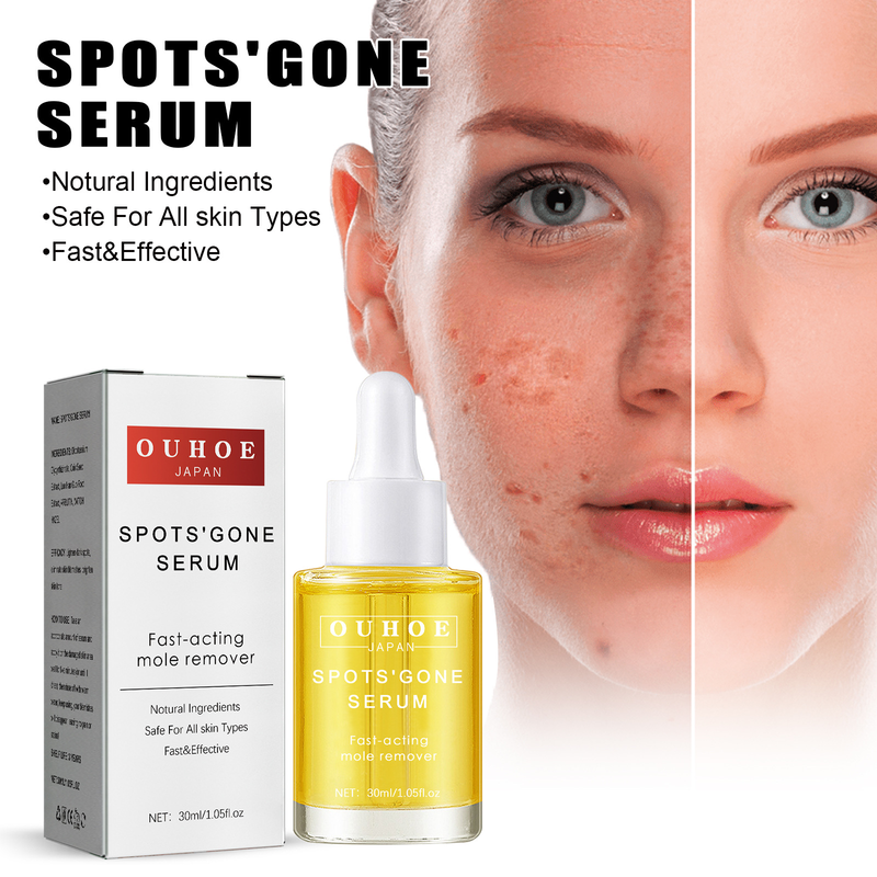 OUHOE Spot Liquid attenua le macchie nere, le macchie acneiche, schiarisce la pelle, idrata, essenza anti-età_voghion.com