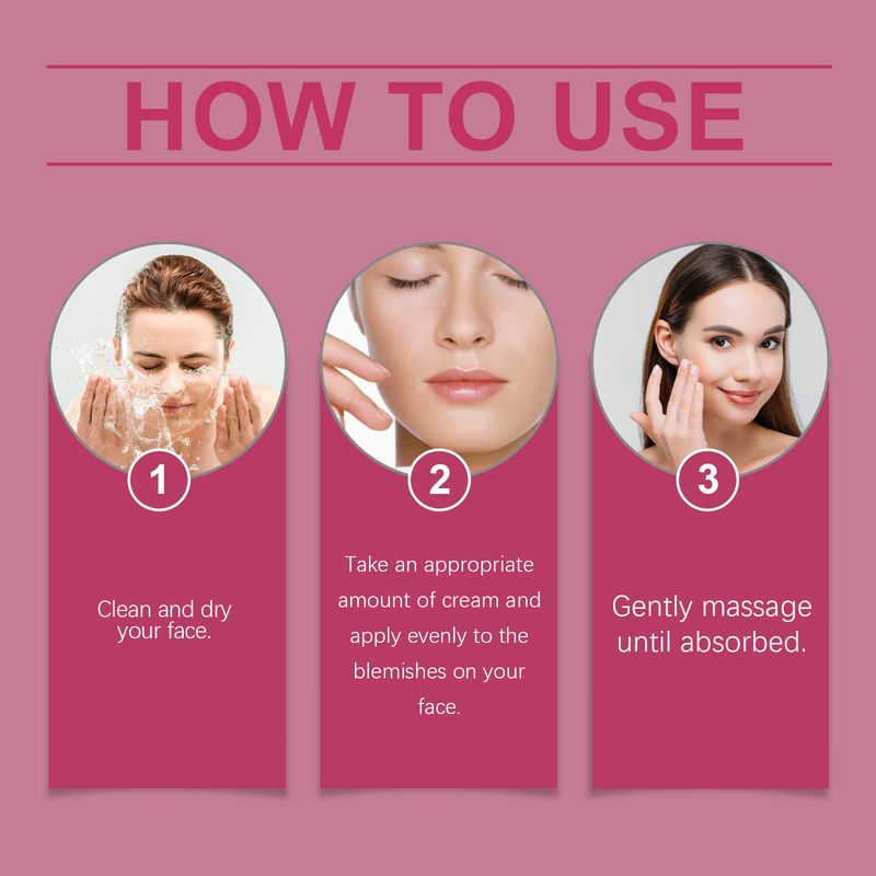 EELHOE Melasma Spotless Concentrate, Moisturizing Firming Skin Refreshing And Dark Spots Skin Creams_voghion.com